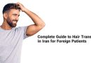 Complete Guide to Hair Transplant in Iran for Foreign Patients